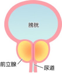 前立腺肥大症の症状について