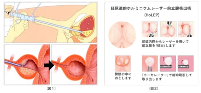 治療方法について