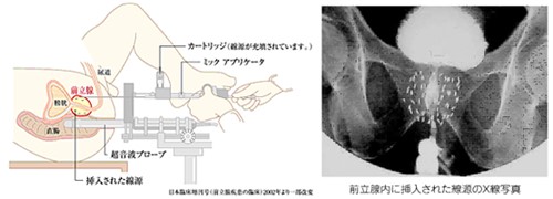 治療の実際